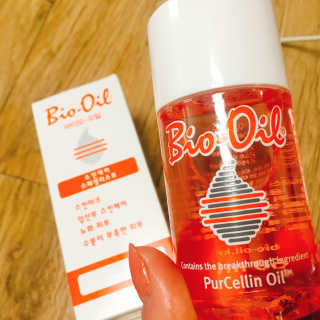 Bio-oil(바이오오일) 바이오오일 — 4점을 준 리뷰어가 2016년 10월 올린 사용 사진