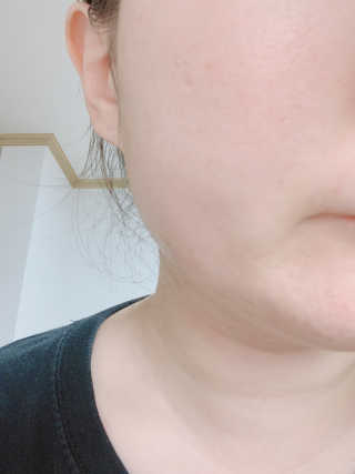 (주)에네스티 미스랩 갈락토미세스 클리어 플러스 에센스 — 4.5점을 준 리뷰어가 2019년 10월 올린 사용 사진