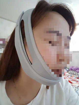 메디미 브이미 업 2스텝 브이라인벨트 — 5점을 준 리뷰어가 2017년 5월 올린 사용 사진