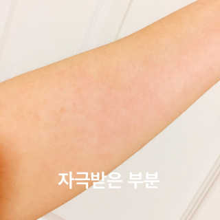 벤튼 티트리 클렌징 워터 — 4점을 준 리뷰어가 2018년 3월 올린 사용 사진