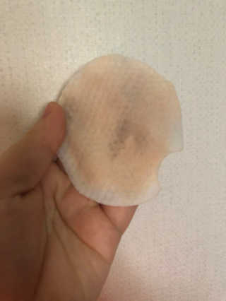 나이팅게일 데일리 더마 클렌징패드 마일드 — 5점을 준 리뷰어가 2018년 3월 올린 사용 사진