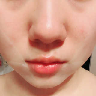 리체 뷰랑셀 케어 스팟 포인트팩 — 4.67점을 준 리뷰어가 2017년 7월 올린 사용 사진