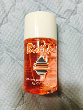 Bio-oil(바이오오일) 바이오오일 — 4.5점을 준 리뷰어가 2016년 10월 올린 사용 사진