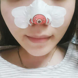 나이팅게일 TAKO PACK NOSE [문어코팩] — 4점을 준 리뷰어가 2017년 4월 올린 사용 사진