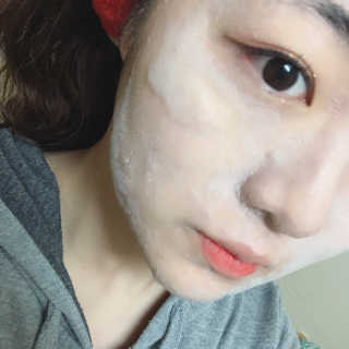 셀퓨전씨 트리악 포어 딜리트 버블 팩 — 4.5점을 준 리뷰어가 2018년 4월 올린 사용 사진