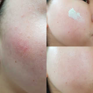 셀퓨전씨 카밍 다운 크림 — 5점을 준 리뷰어가 2018년 11월 올린 사용 사진