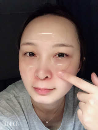 아이디플라코스메틱 아이디 페이스핏 플러스 패치 — 3.5점을 준 리뷰어가 2019년 10월 올린 사용 사진