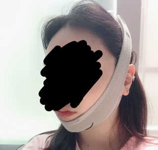메디미 브이미 업 2스텝 브이라인벨트 — 4.17점을 준 리뷰어가 2017년 9월 올린 사용 사진