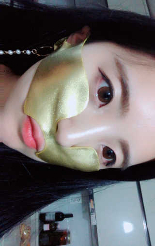 [스케덤] 상악밴드 — 3.5점을 준 리뷰어가 2019년 6월 올린 사용 사진