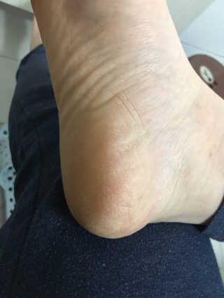 우은지님이 올린 리뷰 사진 2