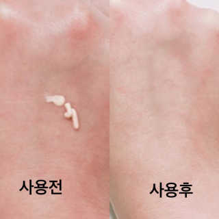 딜라잇18 I.U 화이트닝크림 살몬스팟 — 4점을 준 리뷰어가 2017년 1월 올린 사용 사진