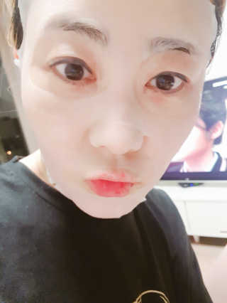 라인플라츠 인텐시브 업 화이트닝 블루베리 마스크 — 5점을 준 리뷰어가 2019년 2월 올린 사용 사진