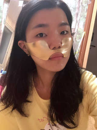 [스케덤] 상악밴드 — 3.5점을 준 리뷰어가 2019년 8월 올린 사용 사진