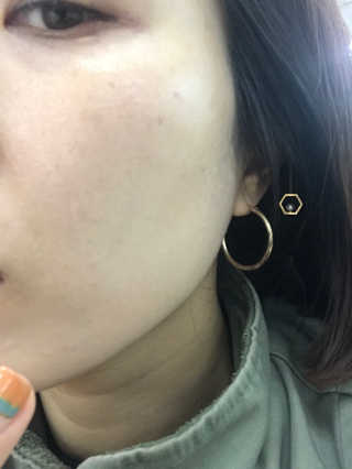 히스토메르 코리아 히스토메르씨-멀티 액션 퓨어 비타민 — 3.5점을 준 리뷰어가 2019년 1월 올린 사용 사진