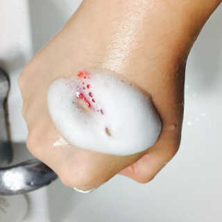 세바메드 클리어 페이스 안티박테리얼 클렌징 폼 — 4.67점을 준 리뷰어가 2017년 6월 올린 사용 사진