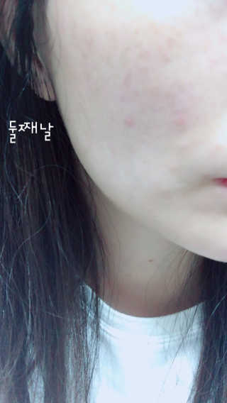 아이소이 파란소화기 응급스팟 — 5점을 준 리뷰어가 2017년 7월 올린 사용 사진