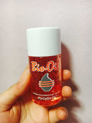Bio-oil(바이오오일) 바이오오일 — 4.5점을 준 리뷰어가 2016년 10월 올린 사용 사진
