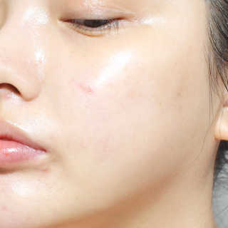 GoodDay Skincare GoodDay 강황 마스크 — 4점을 준 리뷰어가 2020년 2월 올린 사용 사진