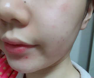 라포랩 laforlab 라포랩 센텔라스카 연고(바질) — 5점을 준 리뷰어가 2017년 12월 올린 사용 사진