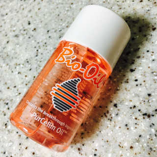 Bio-oil(바이오오일) 바이오오일 — 4점을 준 리뷰어가 2016년 10월 올린 사용 사진