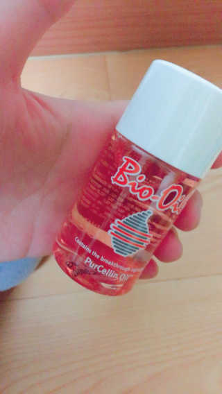 Bio-oil(바이오오일) 바이오오일(Bio-oil) — 3.5점을 준 리뷰어가 2017년 1월 올린 사용 사진