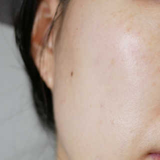 셀퓨전씨 카밍 다운 크림 — 5점을 준 리뷰어가 2018년 11월 올린 사용 사진