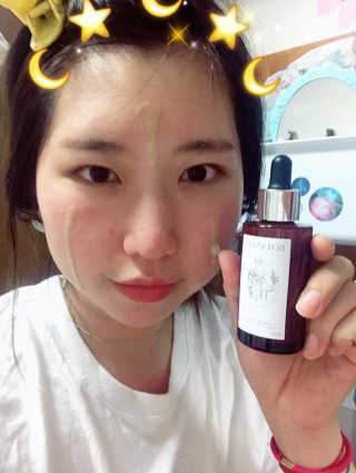 보타니티 [홍]조[진]정[결]케어 플라본 세럼 — 4.5점을 준 리뷰어가 2018년 5월 올린 사용 사진