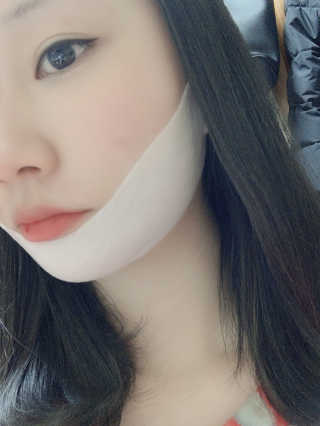 스케덤 클루덤 리프팅 패치 — 3.5점을 준 리뷰어가 2019년 3월 올린 사용 사진