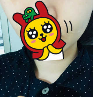 자이엘 S.O.S 레드 칙 케어팩 2 Box — 5점을 준 리뷰어가 2020년 2월 올린 사용 사진