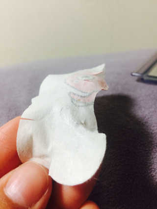 나이팅게일 TAKO PACK NOSE [문어코팩] — 5점을 준 리뷰어가 2017년 9월 올린 사용 사진