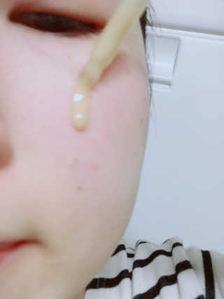 보타니티 [홍]조[진]정[결]케어 플라본 세럼 — 5점을 준 리뷰어가 2018년 5월 올린 사용 사진