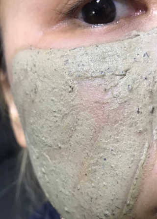 글랜무어 디톡 제올라이트 클리어링 버블 팩 — 5점을 준 리뷰어가 2019년 11월 올린 사용 사진
