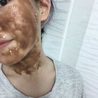 23years old 카카오 에너지 모델링 마스크 — 3.83점을 준 리뷰어가 2017년 5월 올린 사용 사진