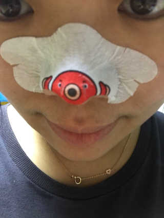 나이팅게일 TAKO PACK NOSE [문어코팩] — 3.5점을 준 리뷰어가 2017년 3월 올린 사용 사진