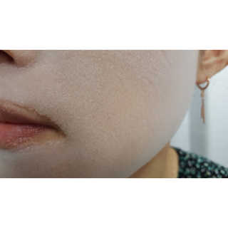 셀퓨전씨 트리악 포어 딜리트 버블 팩 — 5점을 준 리뷰어가 2018년 8월 올린 사용 사진