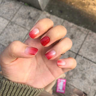 필린 릿티커 — 5점을 준 리뷰어가 2018년 10월 올린 사용 사진