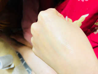 NDR 엔디알 엔디알 피토 에이 앰플 — 4점을 준 리뷰어가 2020년 2월 올린 사용 사진