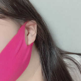 스케덤 펩타이드 리프팅밴드 — 3점을 준 리뷰어가 2019년 7월 올린 사용 사진