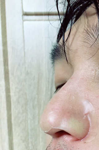메디힐 슬리핑 멜팅 코팩 — 1.5점을 준 리뷰어가 2020년 1월 올린 사용 사진