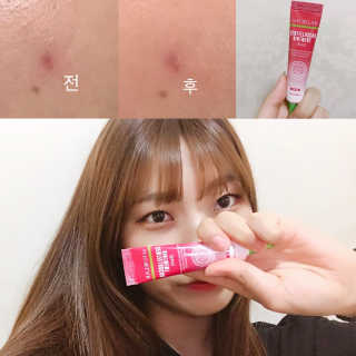 라포랩 laforlab 라포랩 센텔라스카 연고(바질) — 3.5점을 준 리뷰어가 2017년 3월 올린 사용 사진