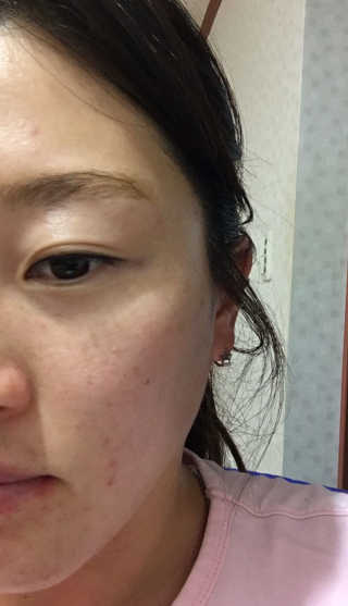 밀키드레스 더 화이트 플래티넘 에디션 — 4점을 준 리뷰어가 2017년 3월 올린 사용 사진