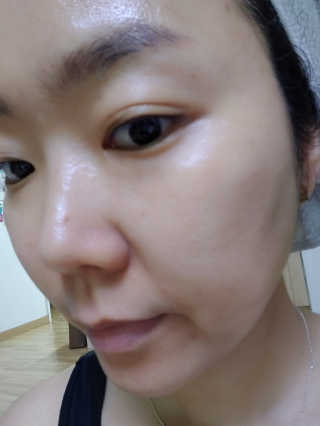 셀리맥스 노니 에너지 앰플 — 5점을 준 리뷰어가 2019년 8월 올린 사용 사진