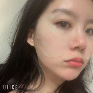 [더마펌] 인텐시브케어 아이존 패치 — 5점을 준 리뷰어가 2019년 10월 올린 사용 사진
