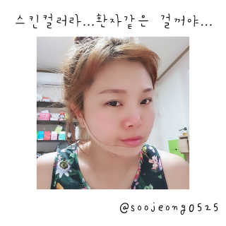 아이디플라코스메틱 아이디 페이스핏 마이너스 밴드 — 4점을 준 리뷰어가 2019년 9월 올린 사용 사진