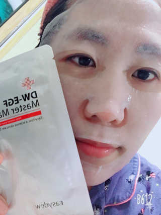 이지듀 피부재생 긴급처방 DW-EGF 마스터 마스크 — 3.83점을 준 리뷰어가 2018년 4월 올린 사용 사진