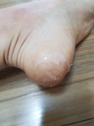 아미니 릴렉싱 풋 필링 스프레이 — 4점을 준 리뷰어가 2019년 4월 올린 사용 사진