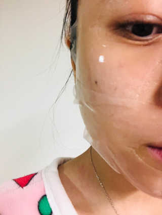 셀더마 마린 콜라겐 하이드로겔 마스크팩 5박스 — 4.5점을 준 리뷰어가 2020년 3월 올린 사용 사진