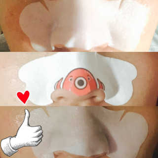나이팅게일 TAKO PACK NOSE [문어코팩] — 4.5점을 준 리뷰어가 2016년 12월 올린 사용 사진