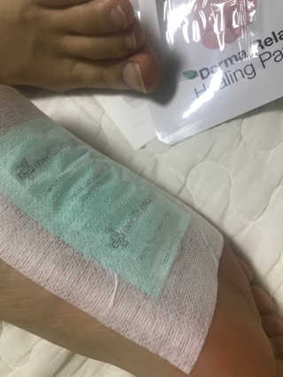메디테라피 더마 릴렉스 힐링패치 — 4.33점을 준 리뷰어가 2018년 4월 올린 사용 사진