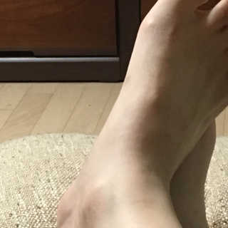 클린앤블락 클린풋 각질 솔루션 — 5점을 준 리뷰어가 2019년 7월 올린 사용 사진